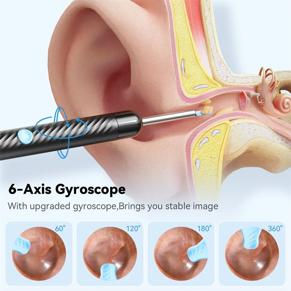 2026 - Eliminación de cerumen