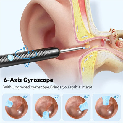 2026 - Eliminación de cerumen