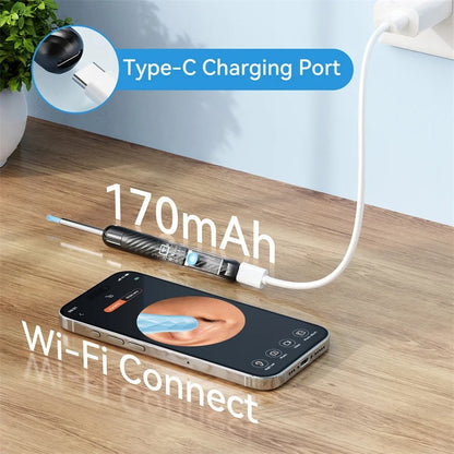 2026 - Eliminación de cerumen